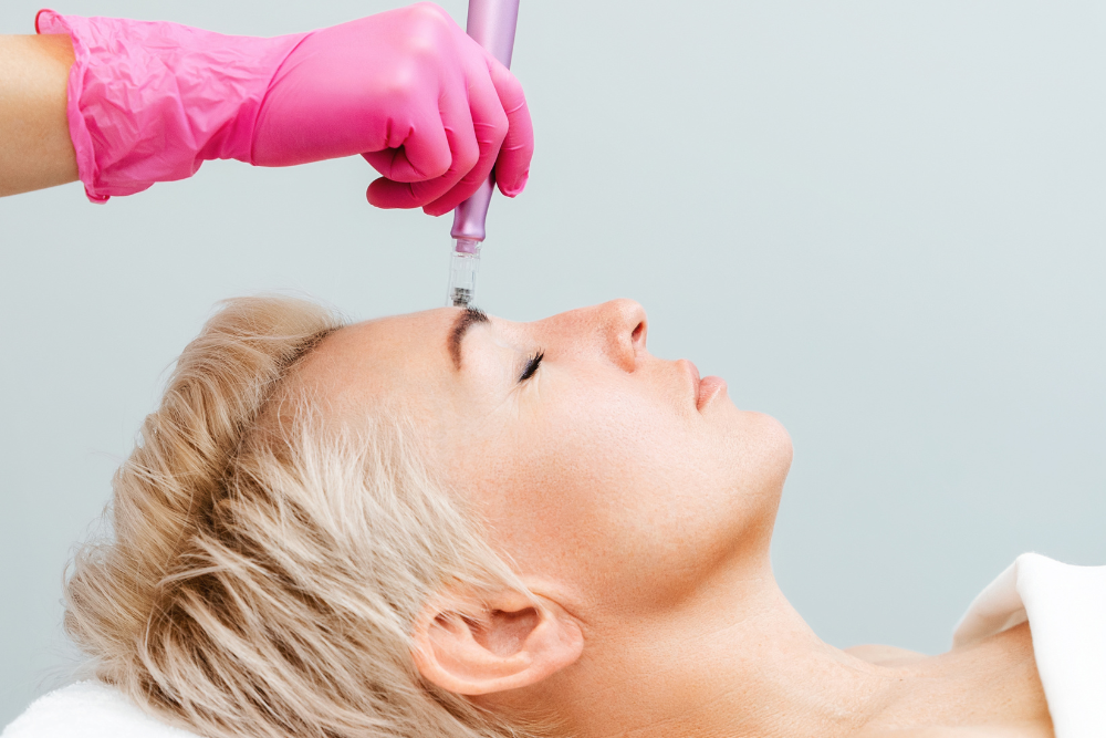 Best Microneedling Prices in Howard County, Maryland