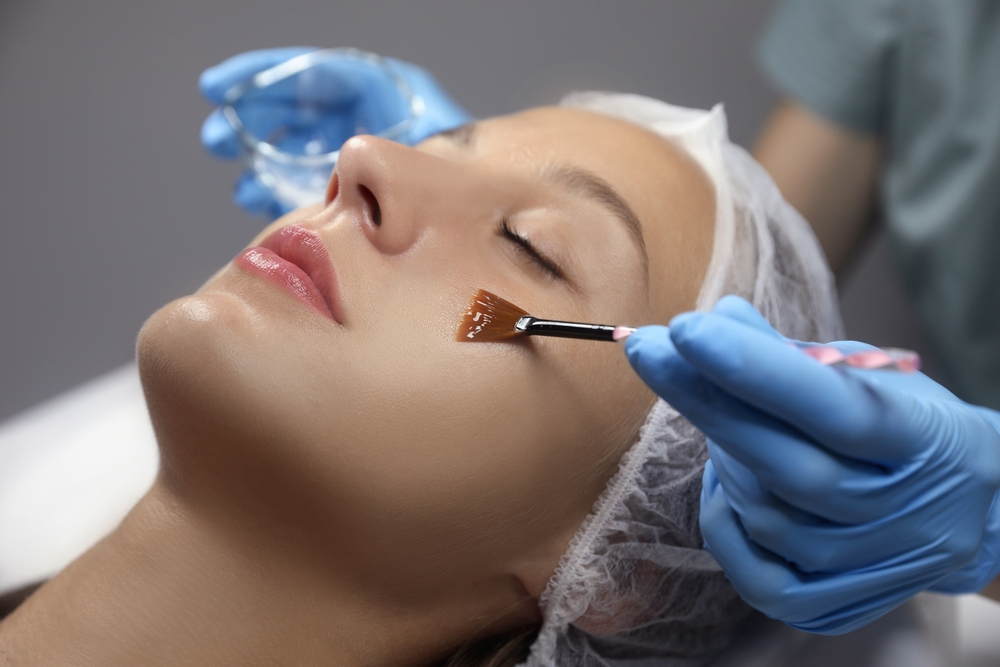 Guide to Chemical Peel Services in Columbia, Maryland for Acne and Skin Renewal