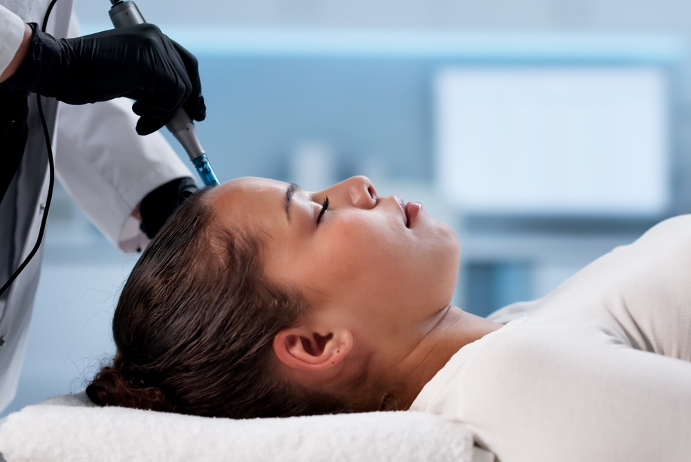 Microneedling Appointment in Columbia