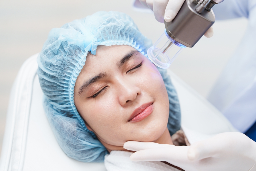 Laser Skin Resurfacing in Howard County, MD: Cost and Recovery